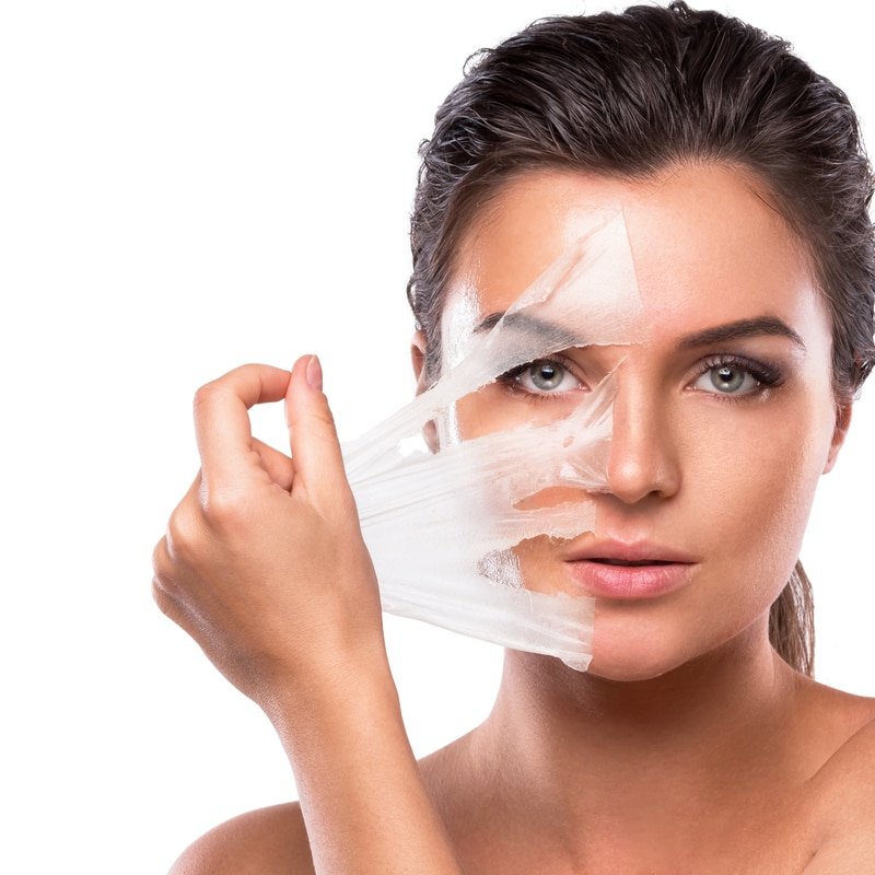 Cosmelan Depigmentation Treatment Clinic