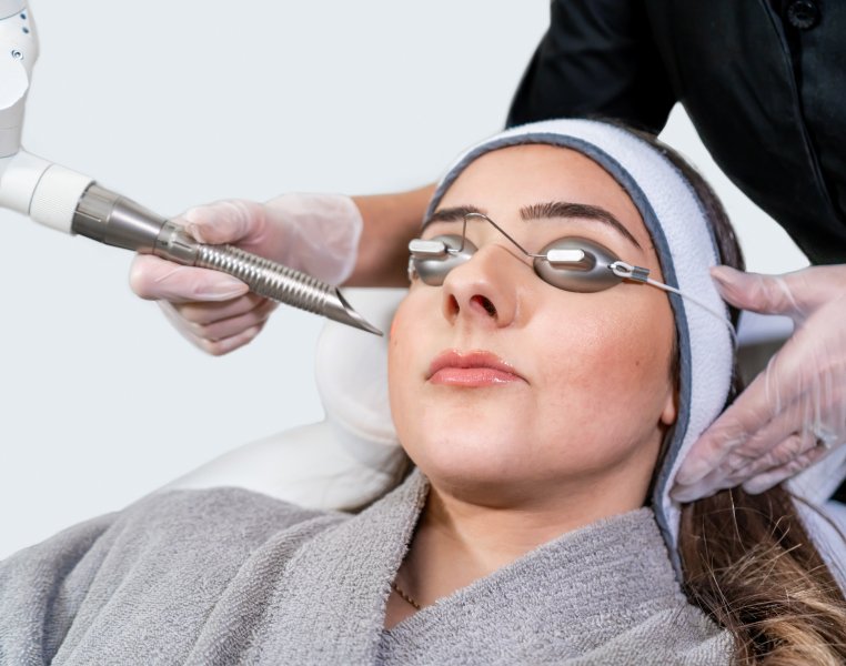 Q-Switch laser treatment, Q-Switched Nd:YAG laser, Laser skin rejuvenation, Pigmentation removal laser, Q-Switch laser for dark spots, Q-Switch laser therapy